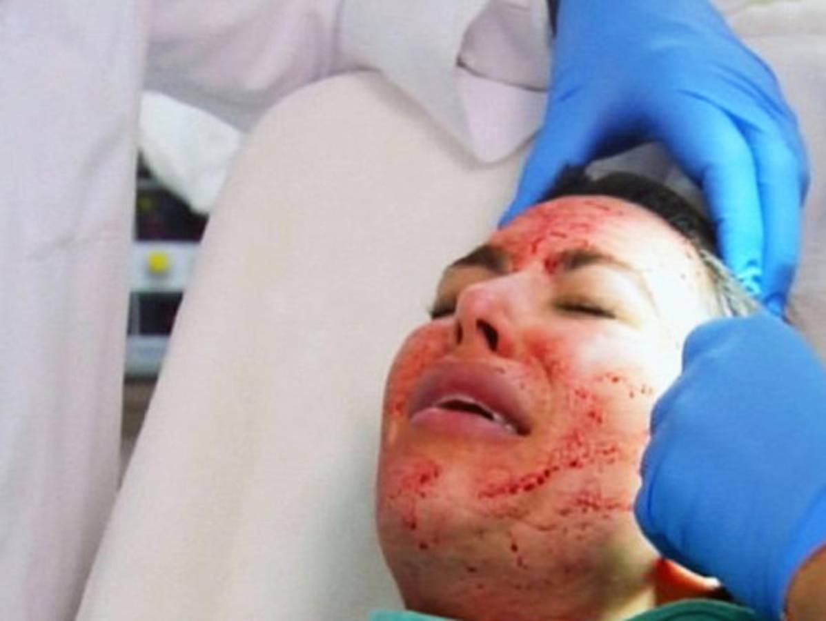 La cara ensangrentada de Kim Kardashian