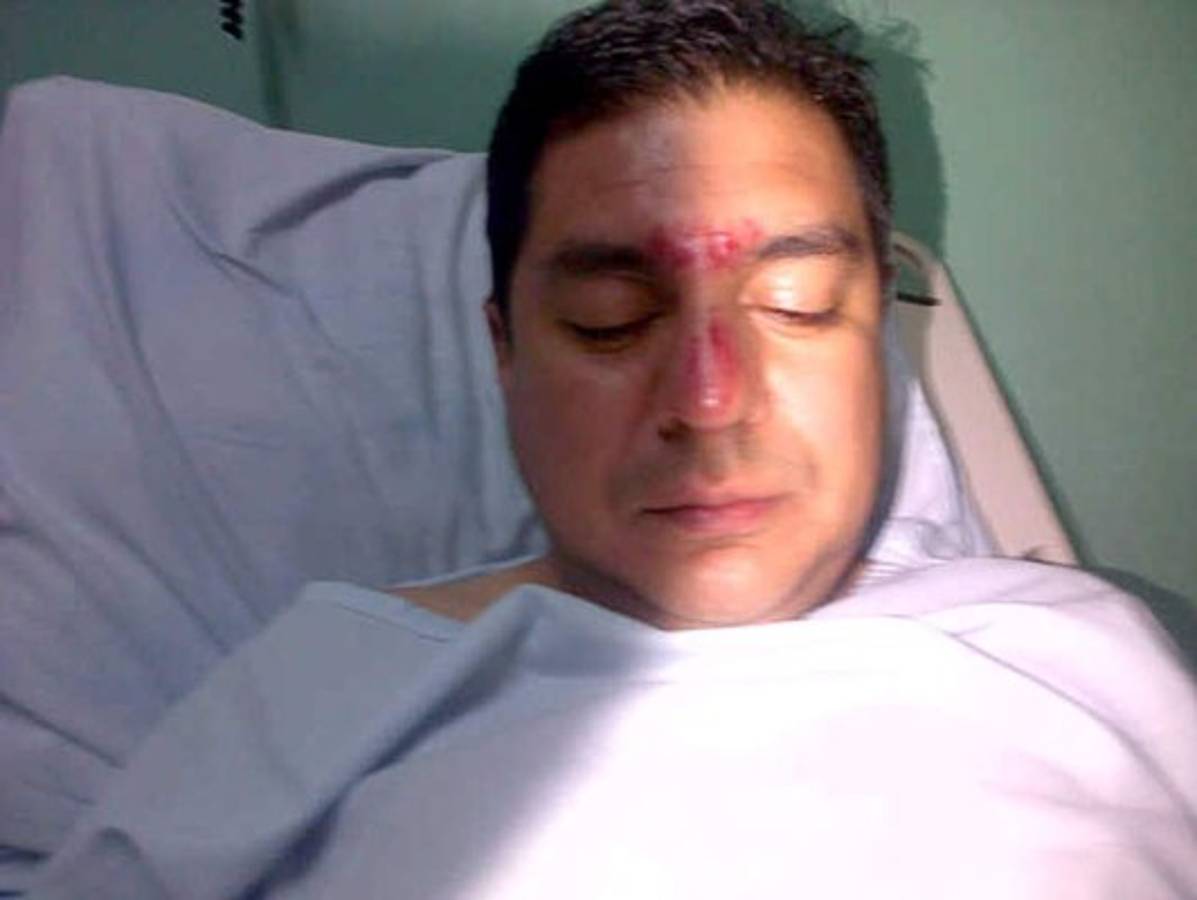 Director de Casa Alianza denuncia golpiza de miembros de la PMOP