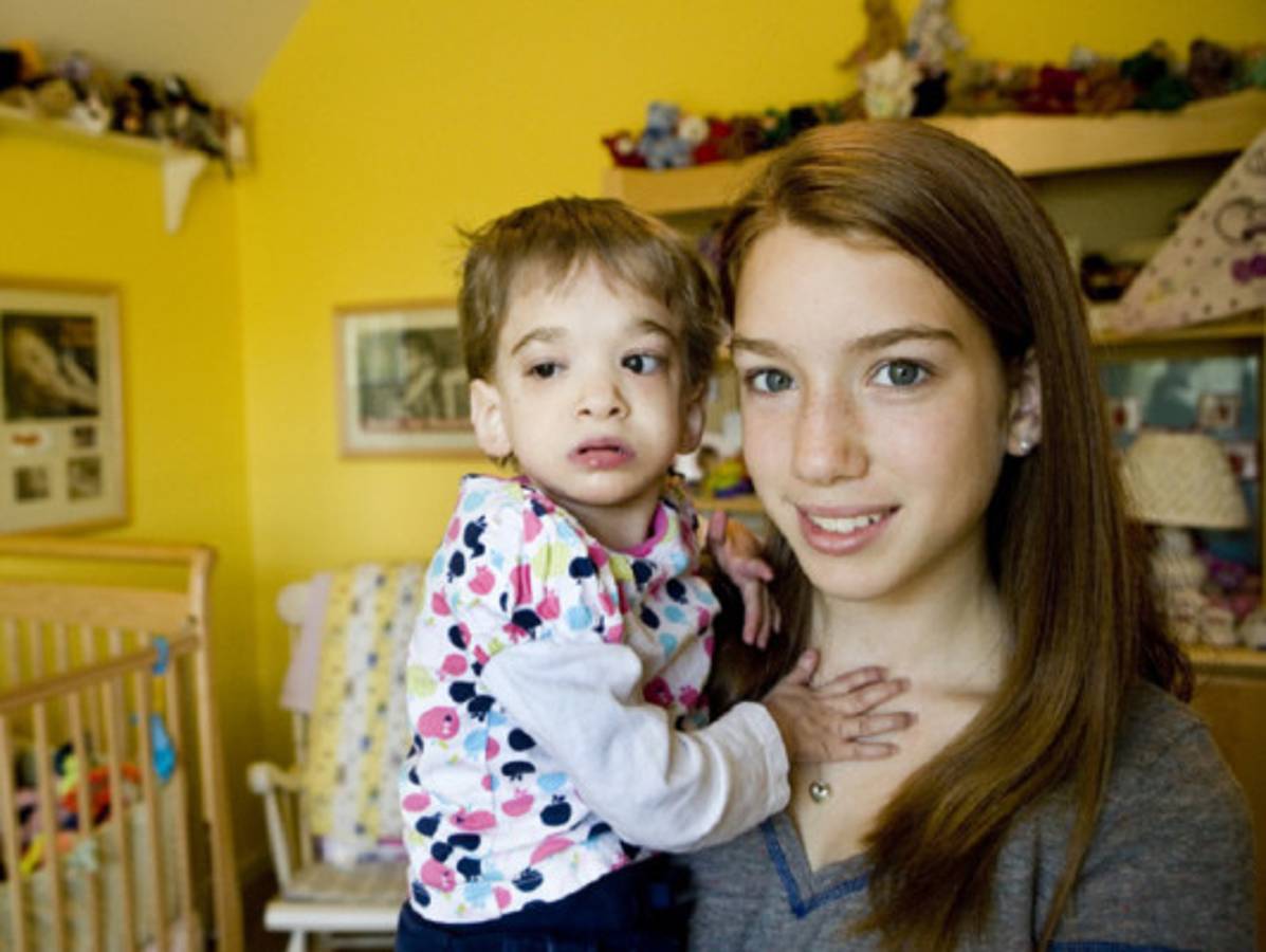 Muere la mujer que dejó de crecer a los dos años