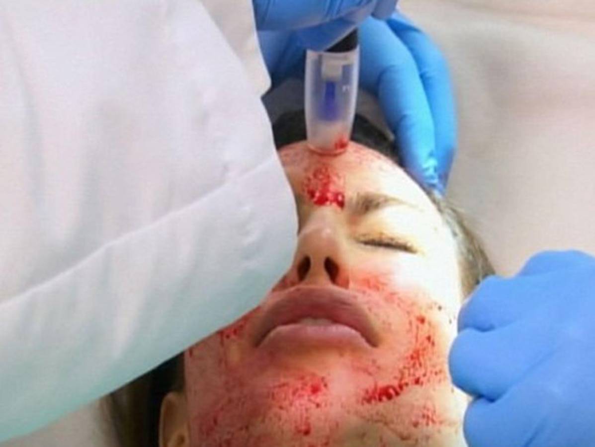 La cara ensangrentada de Kim Kardashian