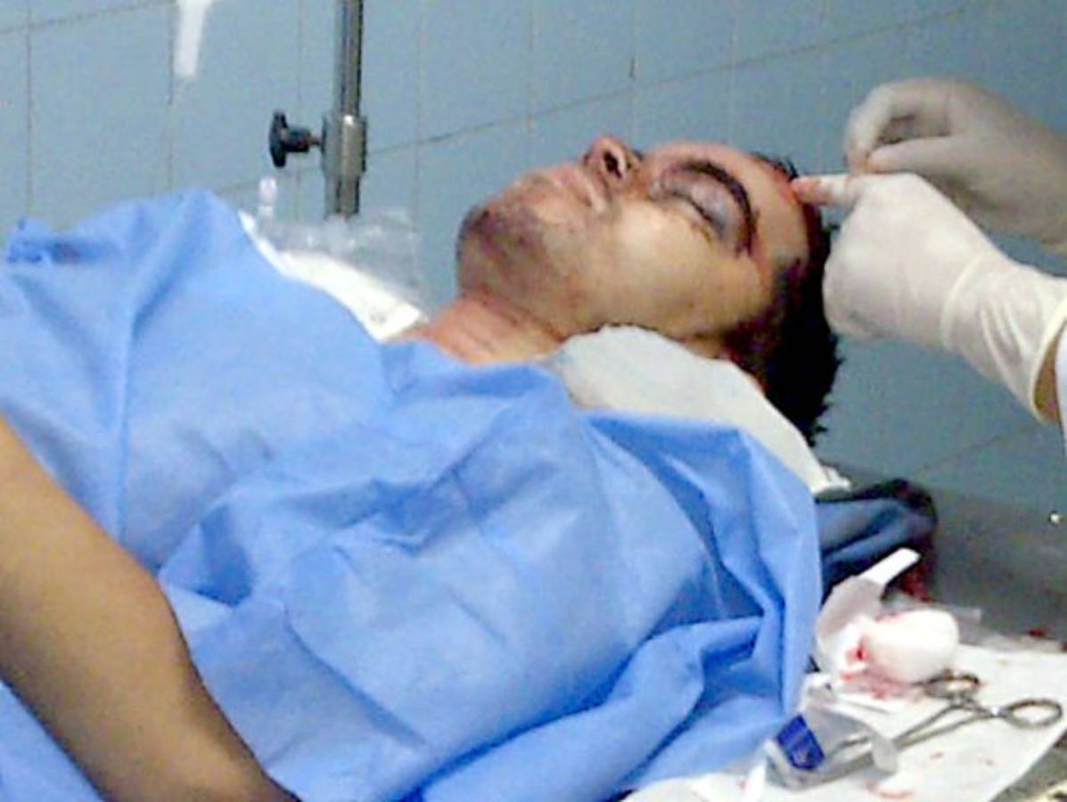 Oficial se lía a balazos con asaltantes