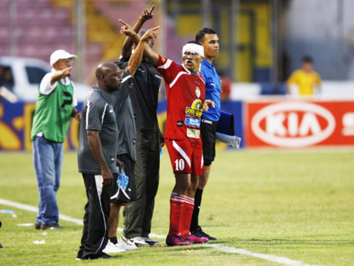 FOTOS: Rambo termina ante Olimpia con el rostro ensangrentado