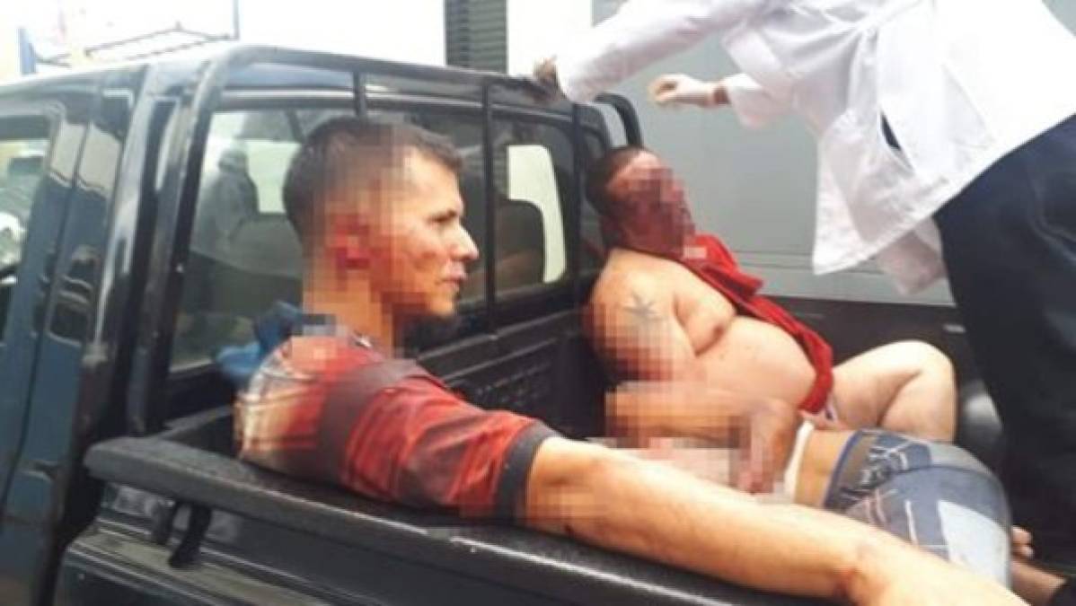 Las fuertes imágenes que dejó un enfrentamiento en la Penitenciaría Nacional de Támara