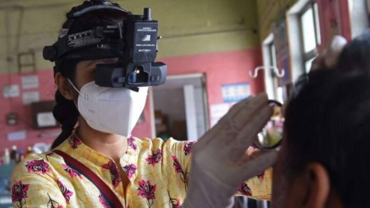 México: Extirpan ojo, parte de nariz y paladar a primer paciente con hongo negro