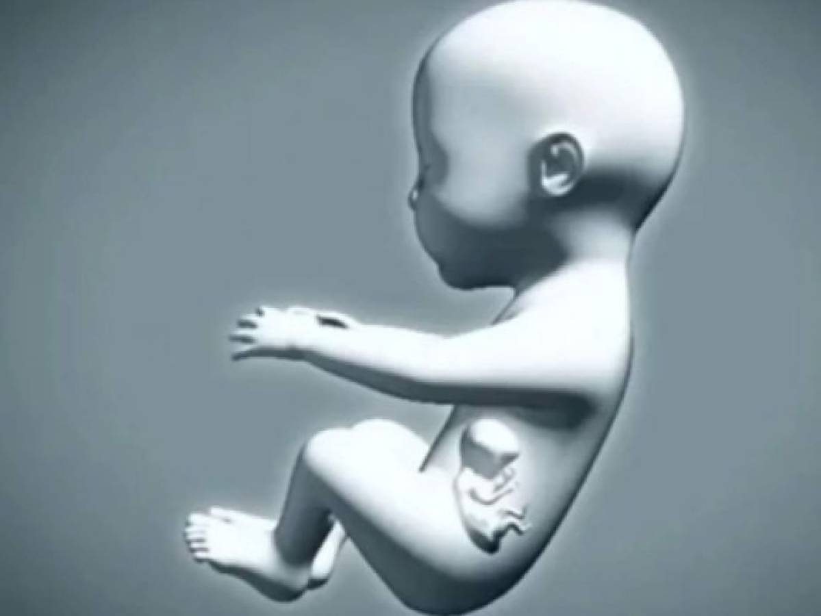 Realizan cesárea a bebé que estaba embarazada de su hermano gemelo en Colombia