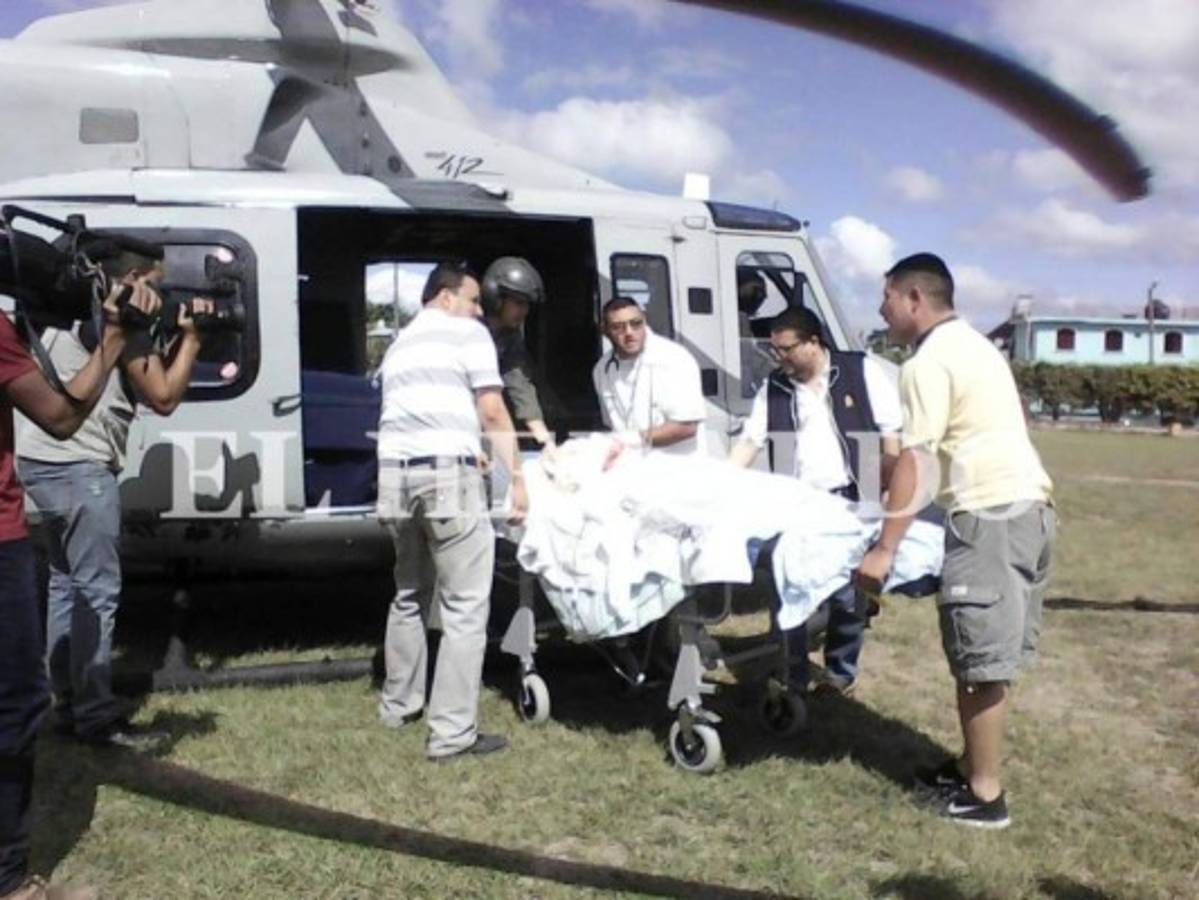 Se reporta la 15 persona quemada por pólvora