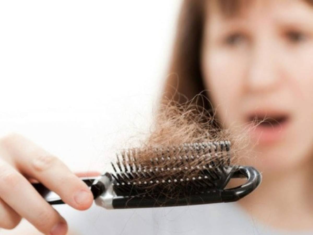 Cuatro motivos por los que se te puede estar cayendo el cabello