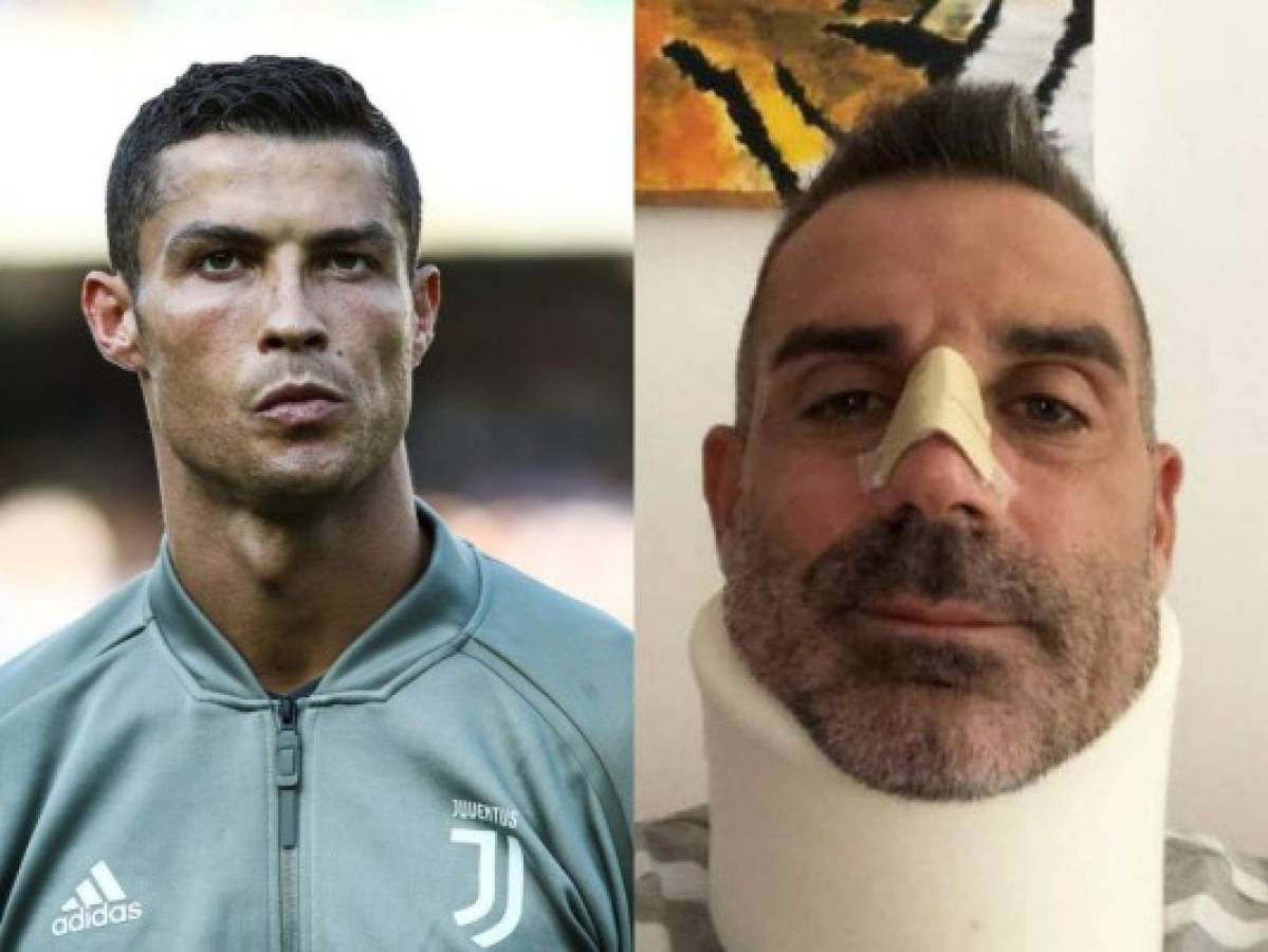 ¿Qué le dijo Cristiano Ronaldo a Sorrentino tras fracturarle la nariz en su debut en Italia?