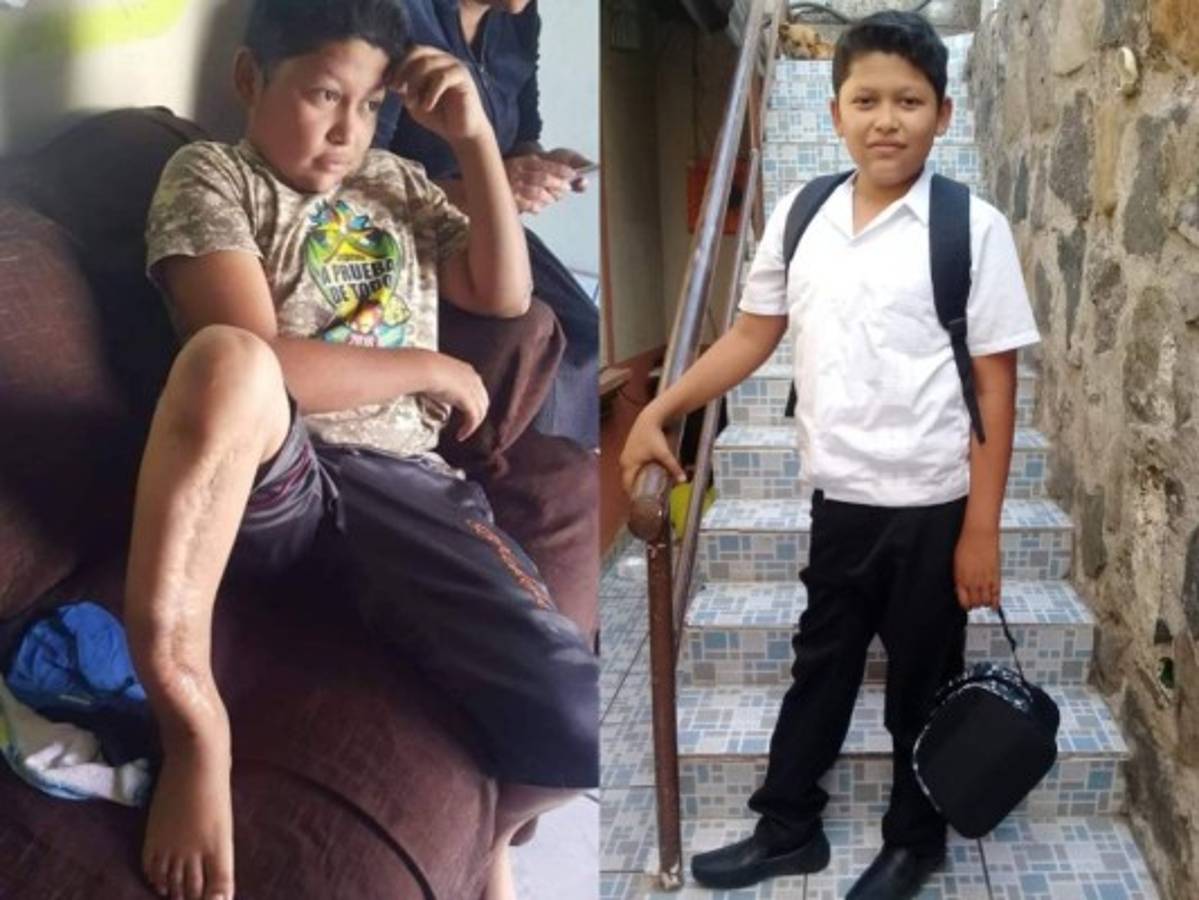 Comienza a llegar ayuda económica para el guerrero Aleck Joan Flores