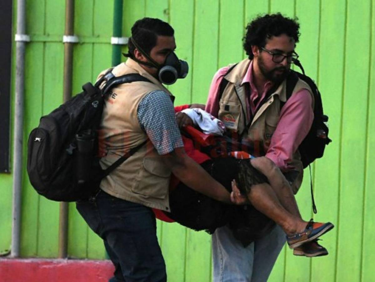Diputado y periodistas salen heridos de marcha de la Alianza de la Oposición