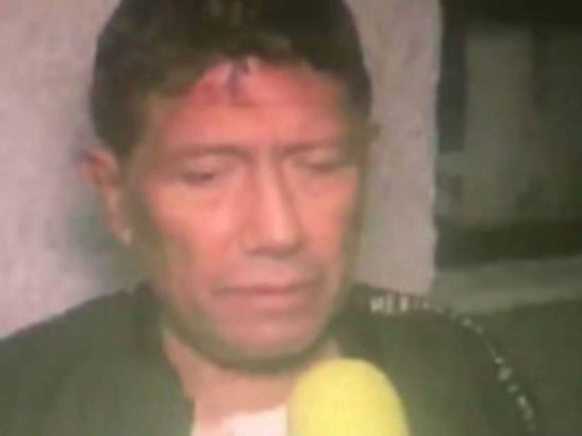 Asaltan y golpean a Juan Osorio dentro de su casa en México  