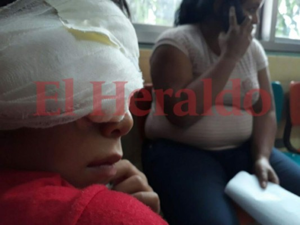 Juzgado de Policía cita a padres de familia por quemadura de sus hijos.