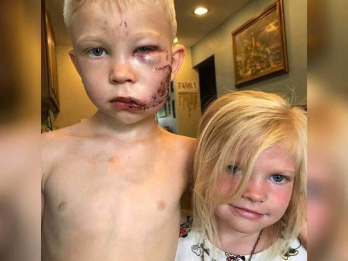 'Si alguien debía morir, tenía que ser yo”: niño que salvó a su hermanita del ataque de un perro