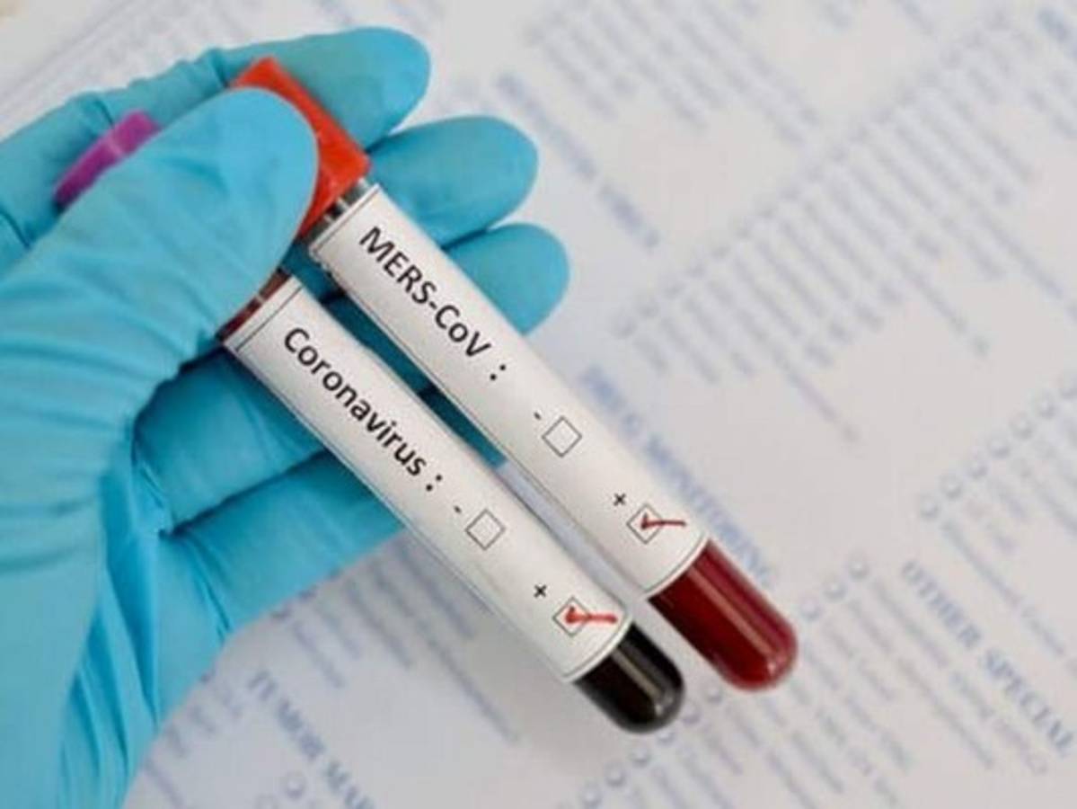 ¿Son lo mismo la Covid-19 y el SRAS?: Aquí sus diferencias