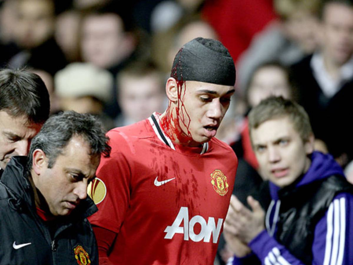 El Athletic de Bilbao logra histórico triunfo sobre el Manchester United en Old Trafford