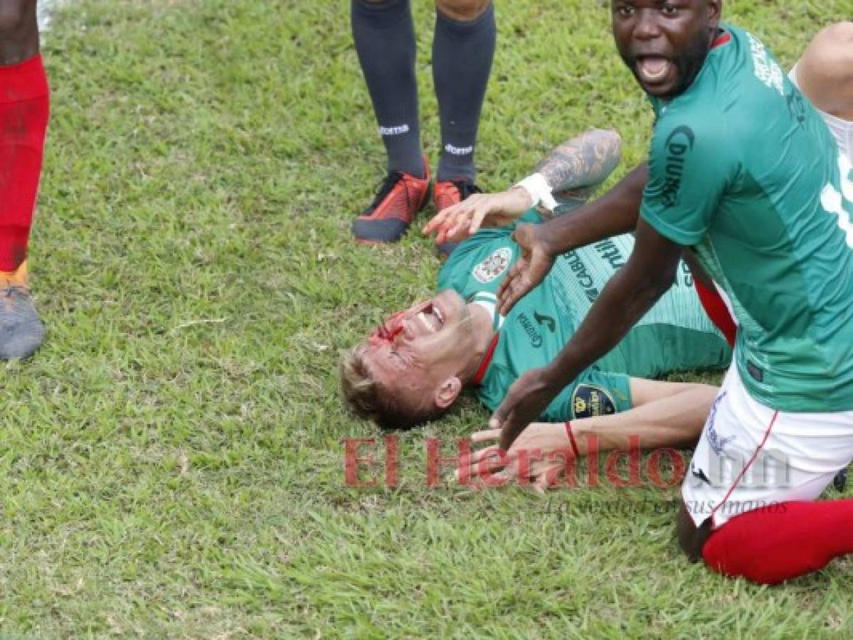 Marathón no pudo con Honduras Progreso y empatan 1-1  