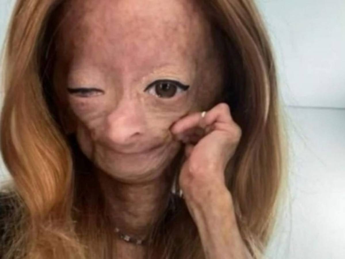 Muere Adalia Rose, la youtuber que sufría un trastorno de envejecimiento