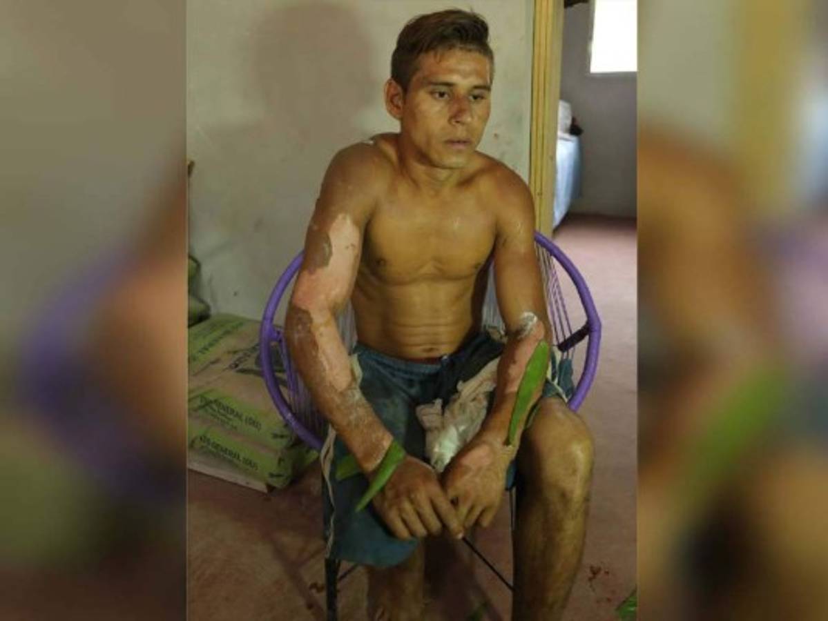 Adán Alberto Ríos Rodríguez salvó la vida de una niña que estaba en la vivienda junto a sus hermanitos que murieron en el siniestro.