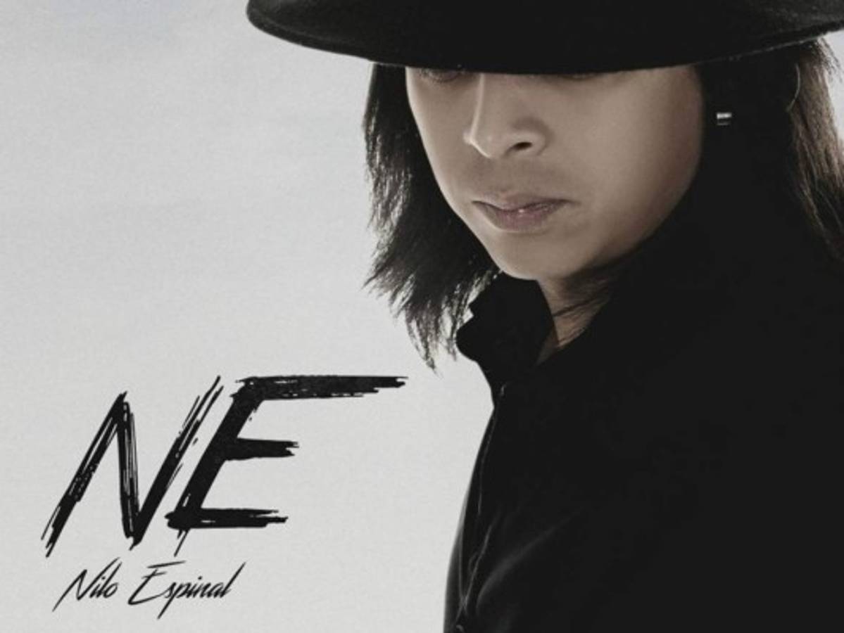 El rockero Nilo Espinal protagoniza accidente vehicular en estado de ebriedad