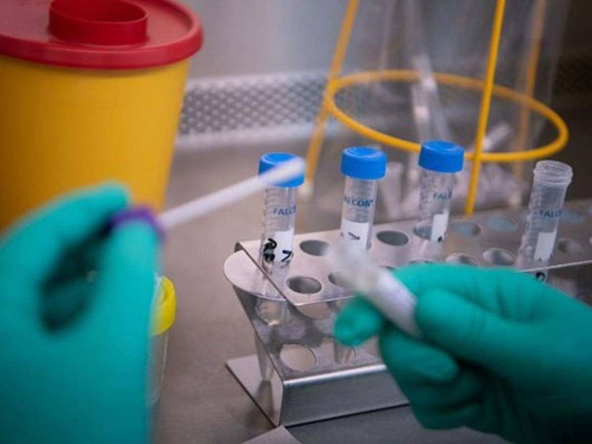 De 49 años y originario de Cortés, lo que se sabe sobre segunda víctima de Covid-19 en Honduras