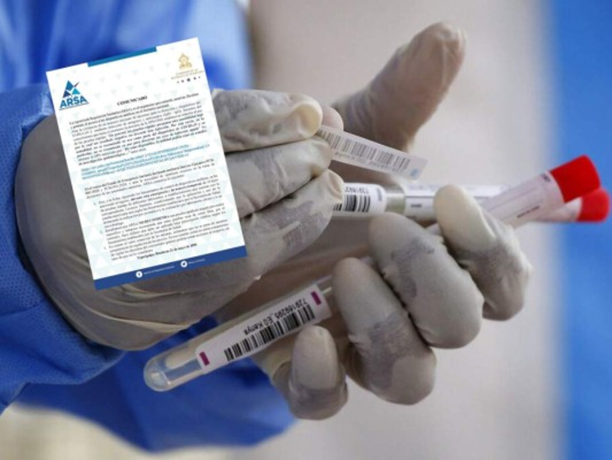 Arsa recomienda hacer pruebas rápidas bajo prescripción médica