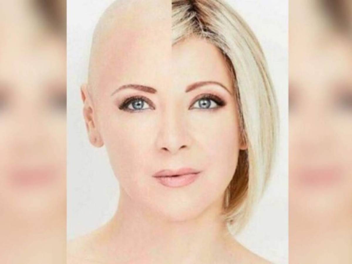 Edith González recupera su cabello después de su lucha contra el cáncer de ovario