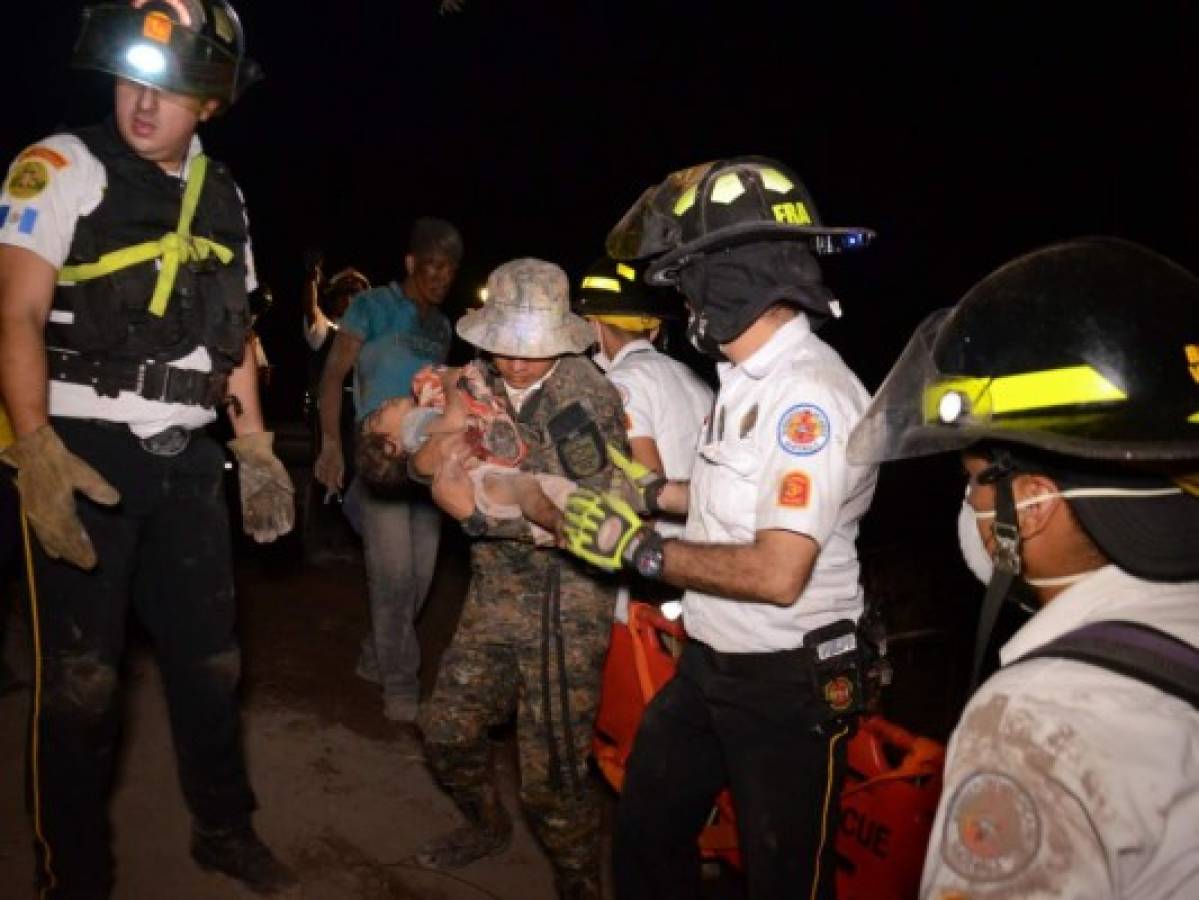 Niños quemado por erupción de volcán en Guatemala serán llevados a Estados Unidos