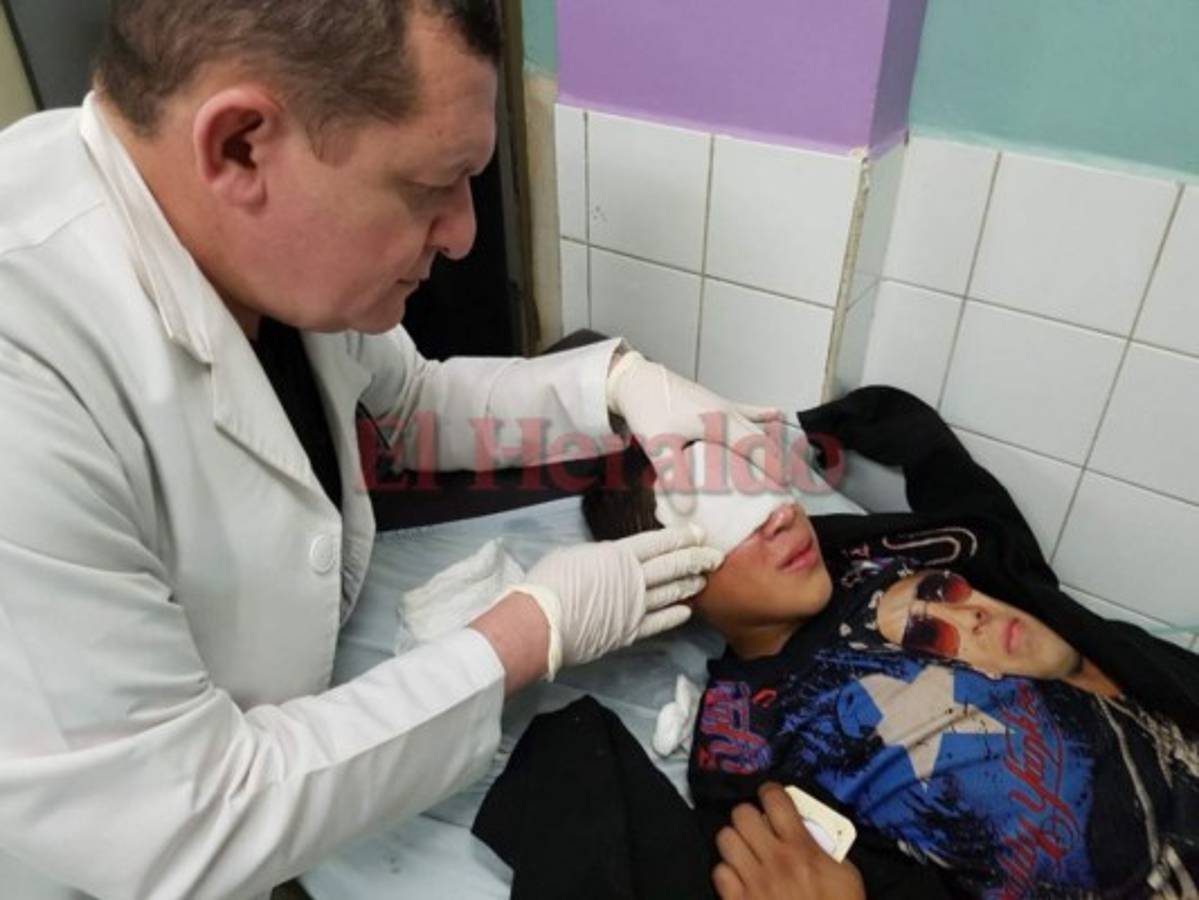 31 quemados por uso de pólvora se reportaron en la Nochebuena en Honduras