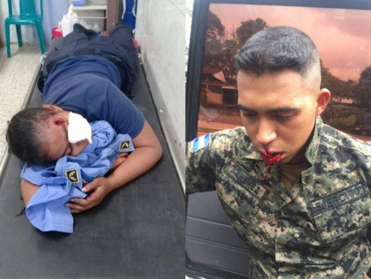 Policías resultan heridos en protestas de la Alianza