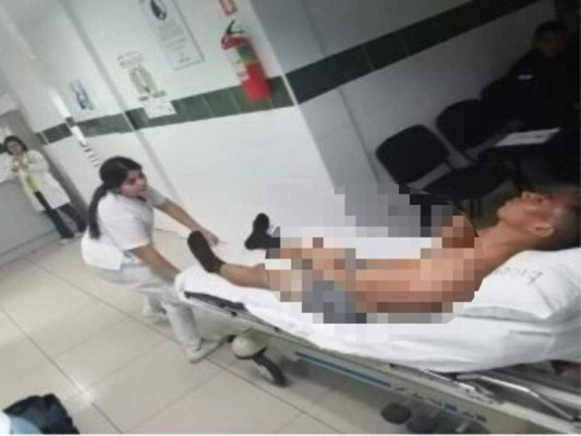 Policía agredido en la UNAH se recupera de la golpiza