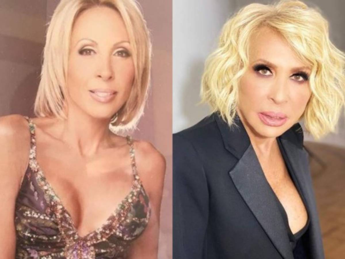 Filtran foto de Laura Bozzo antes de sus cirugías plásticas