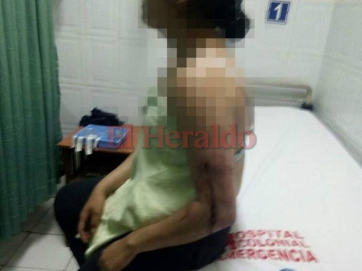 Un policía muerto y varios heridos tras emboscada de delincuentes en El Rosario, Comayagua