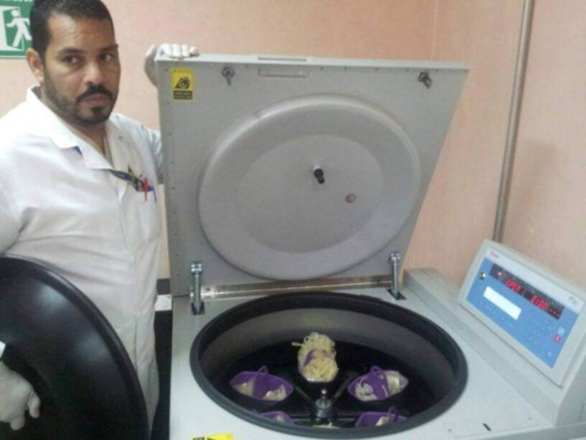 El HEU triplica capacidad de separación de componentes de la sangre  