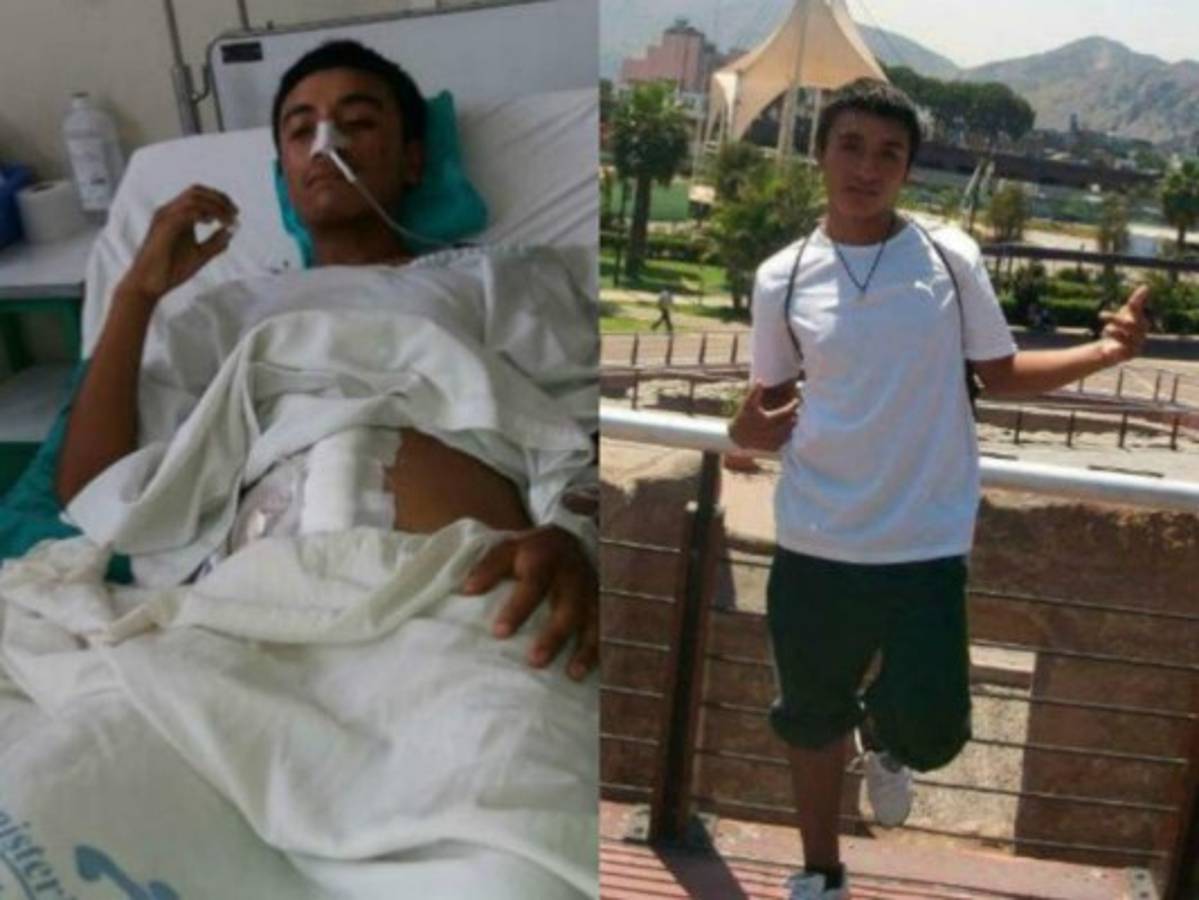 El joven fue internado tras recibir una puñalada en su estómago.