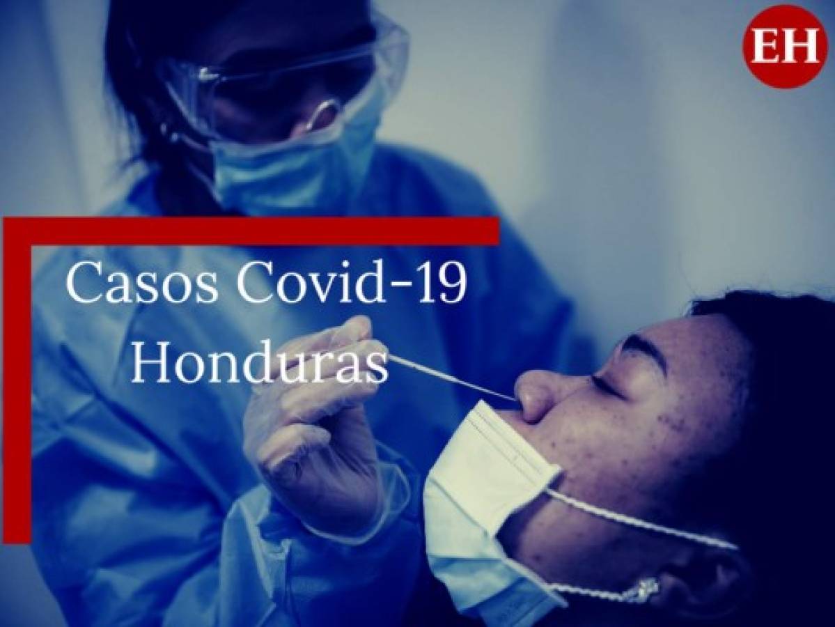 Honduras suma 587 nuevos casos de covid-19; hay 405 muertos y 13,943 infectados