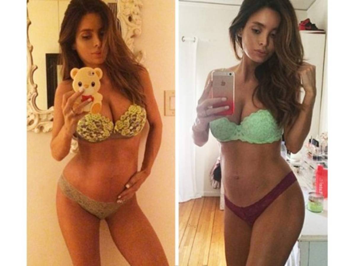 El cuerpo de infarto de una embarazada