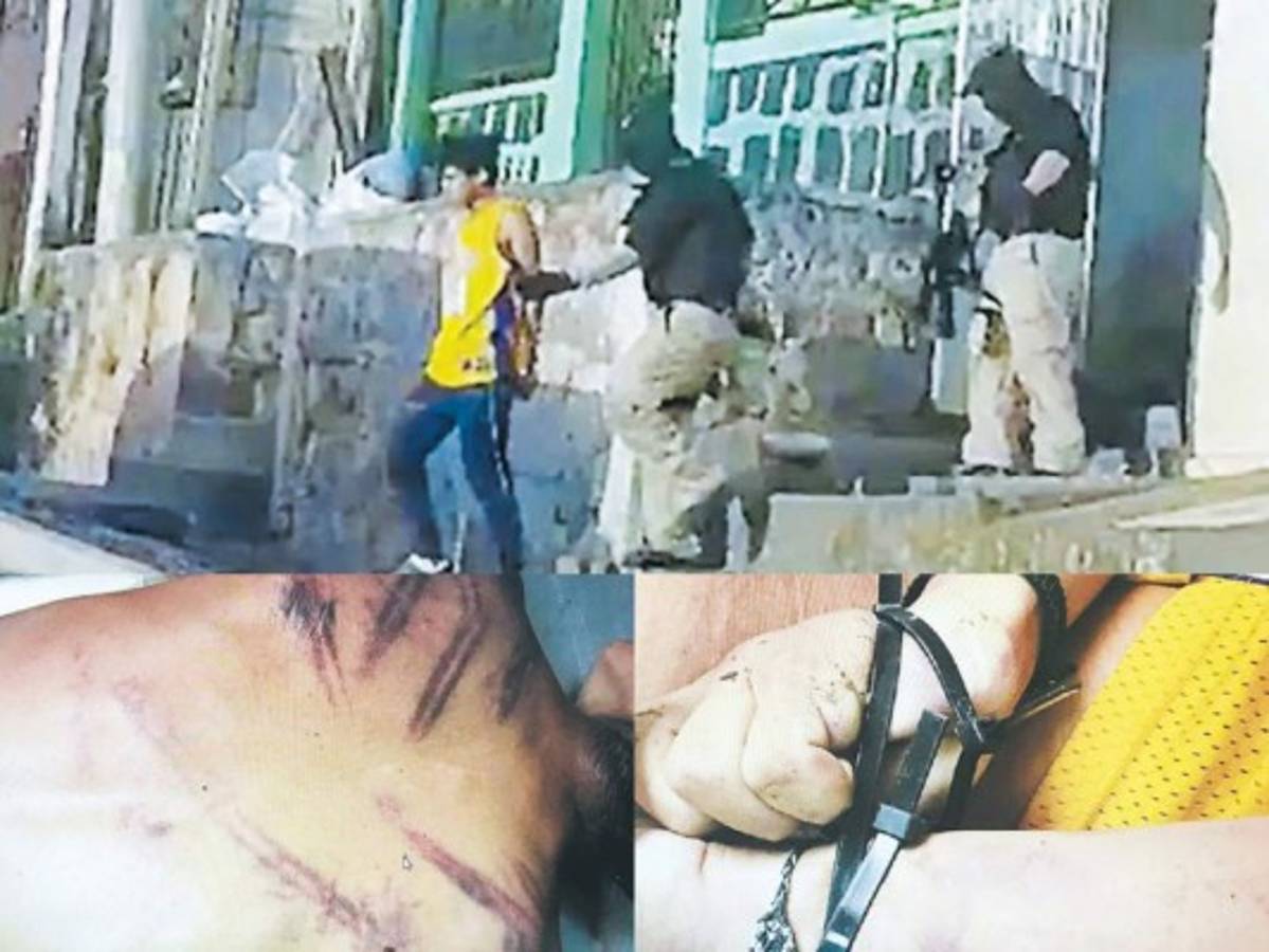 Tanto el tórax como la espalda de las víctimas presentaban múltiples heridas y moretones, producto de la golpiza con un tolete que les propinaron los responsables del repudiable crimen.