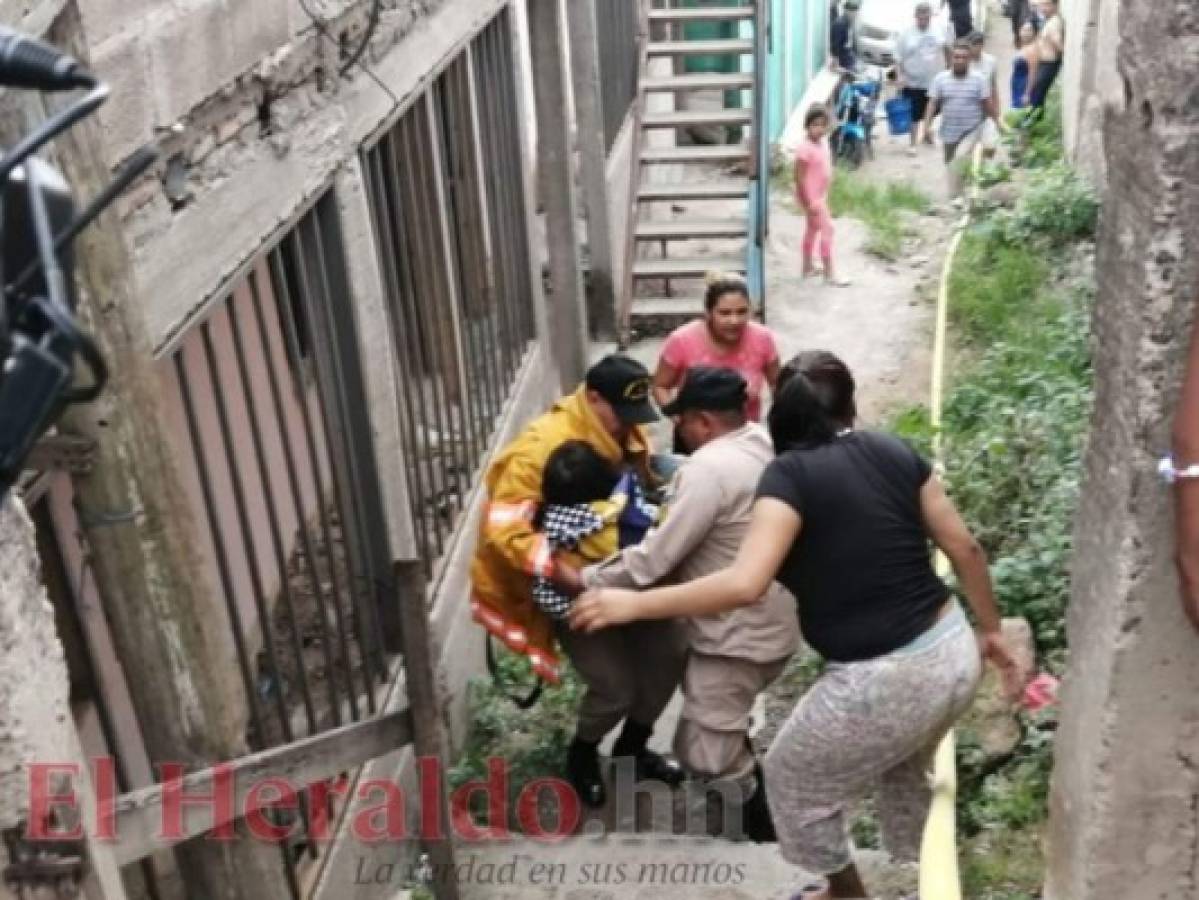 Barrio El Bosque: Mujer resulta con quemaduras tras incendio de su vivienda