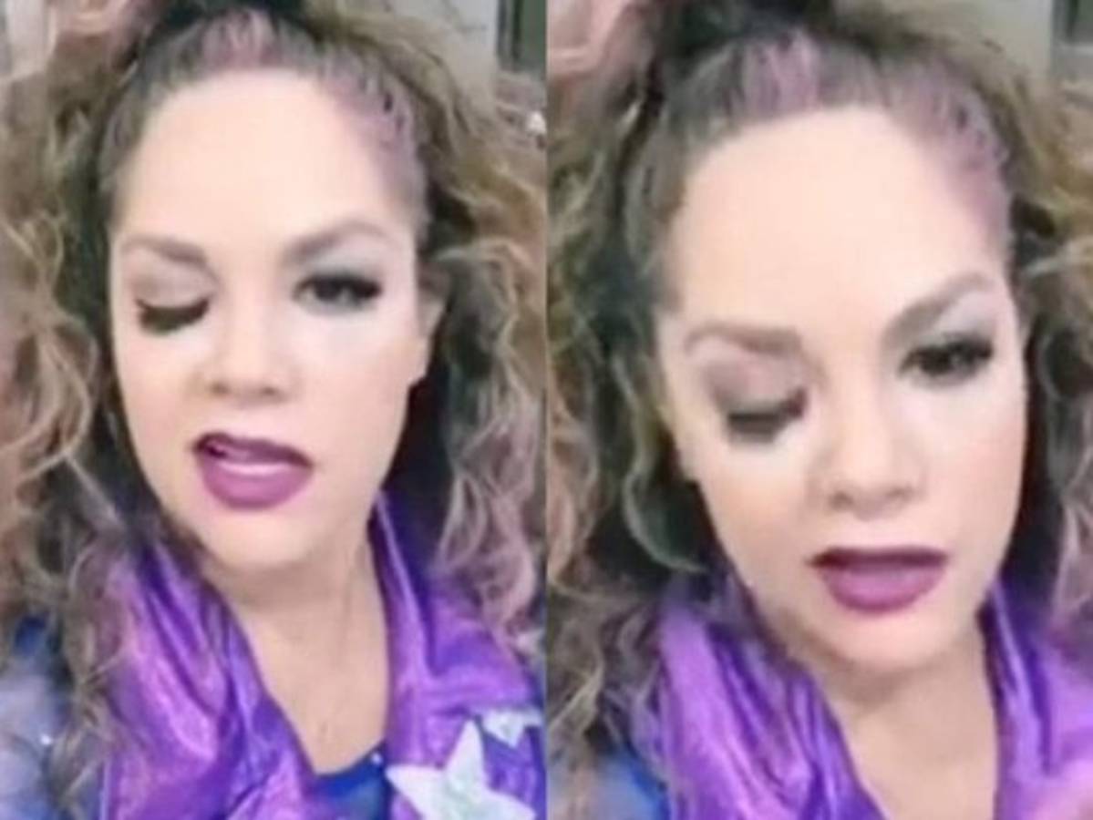 Tatiana sufre parálisis facial, pero se lo toma con humor  