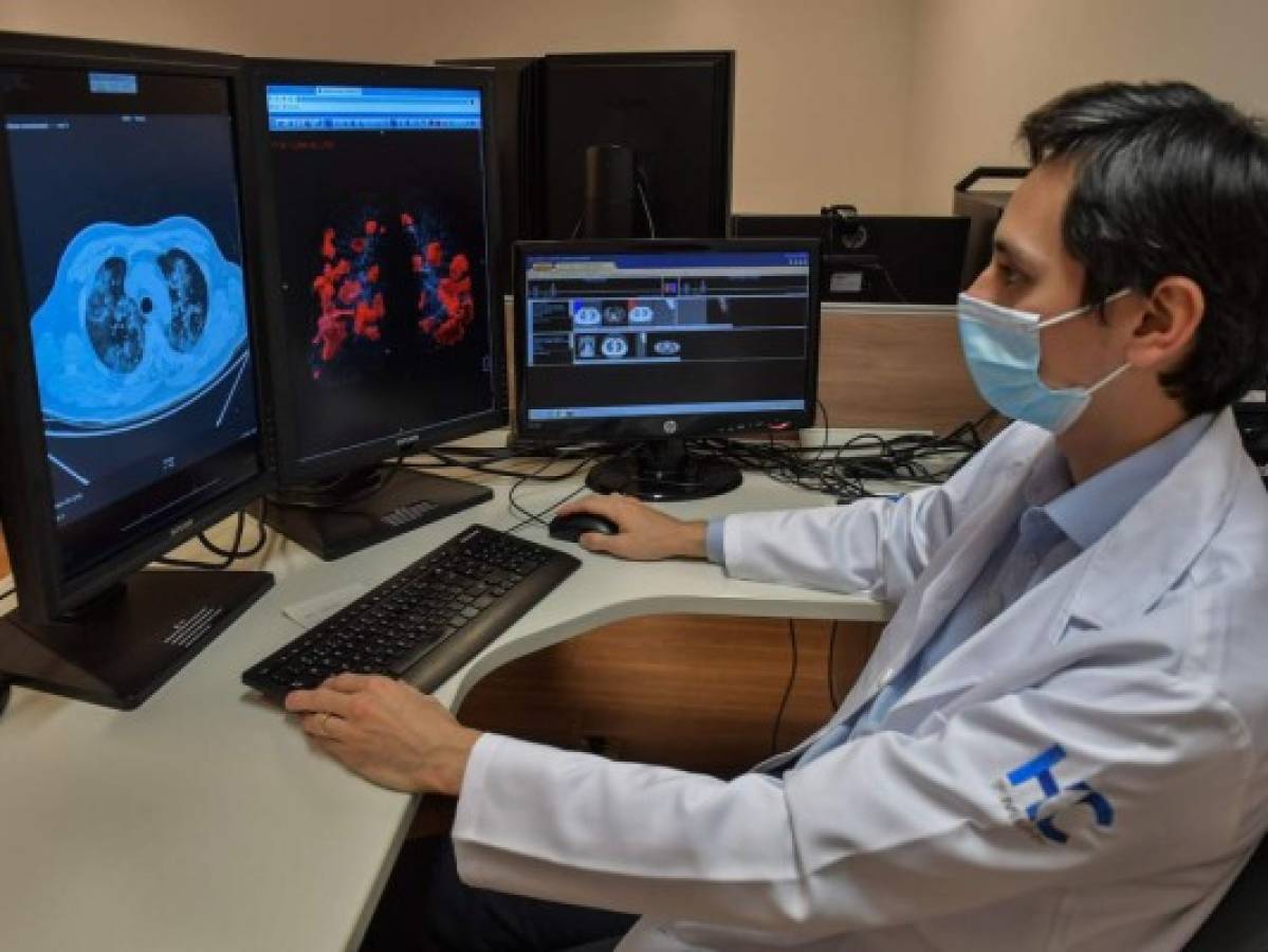 Inteligencia artificial ayuda a diagnosticar covid-19 en Brasil