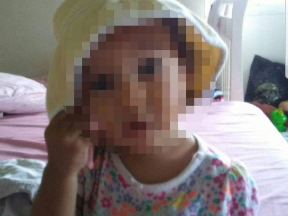 Menor de tres años muere atropellada en Catacamas  