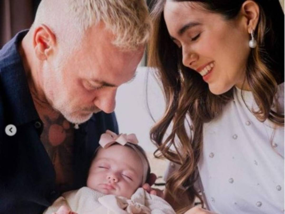 Blu, hija de Gianluca Vacchi y Sharon Fonseca, nació con paladar hendido