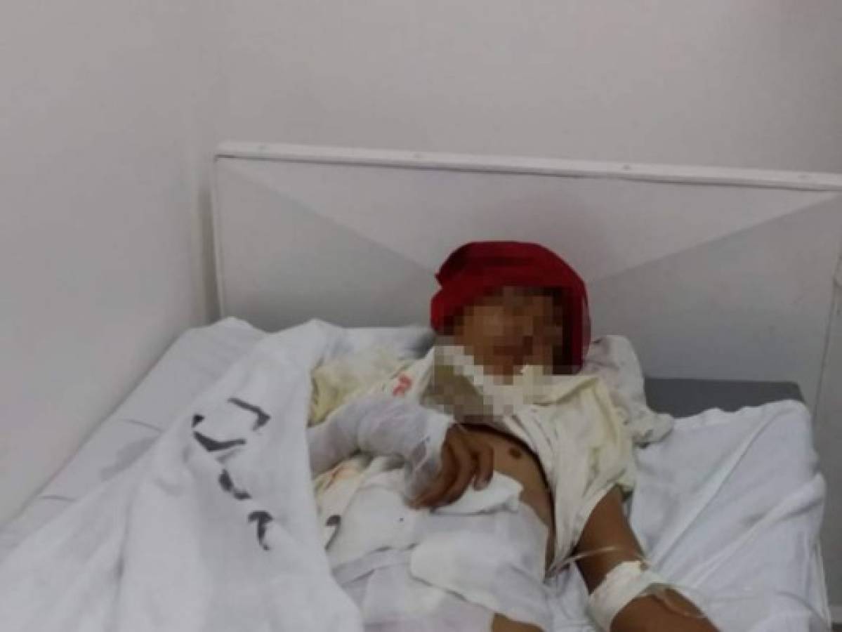 Menor de 14 años sobrevive al impacto de un rayo en Marcovia, Choluteca
