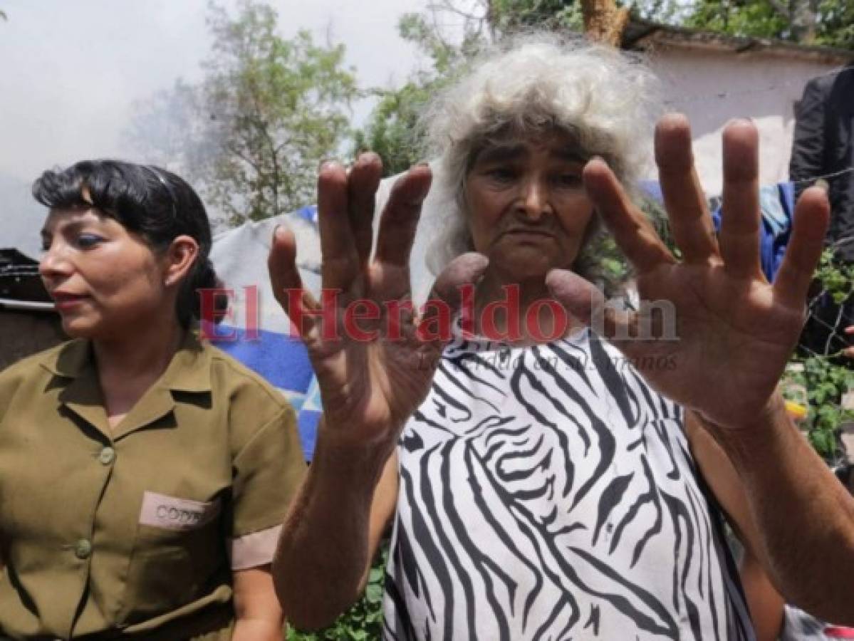 Doña Gloria sufrió quemaduras leves en sus manos y un menor de edad resultó afectado por la inhalación del humo. FOTO: Estalin Irías| EL HERALDO