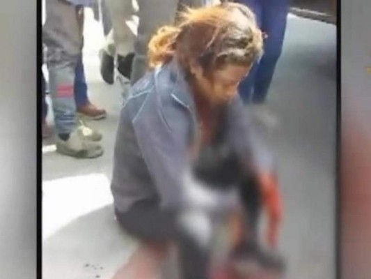 Presunta pandillera pierde la mano con explosivo que intentó lanzar a un bus