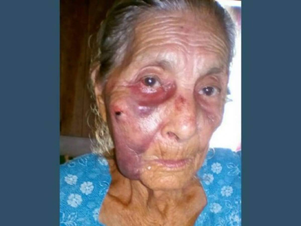 Honduras: Hijo golpea a su madre anciana porque no le tenía la cena