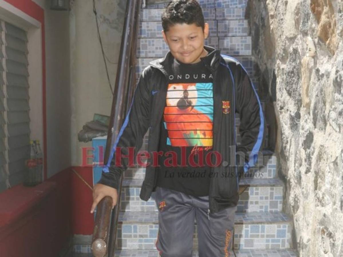 El bullying marcó la vida de Joan, pero no su futuro