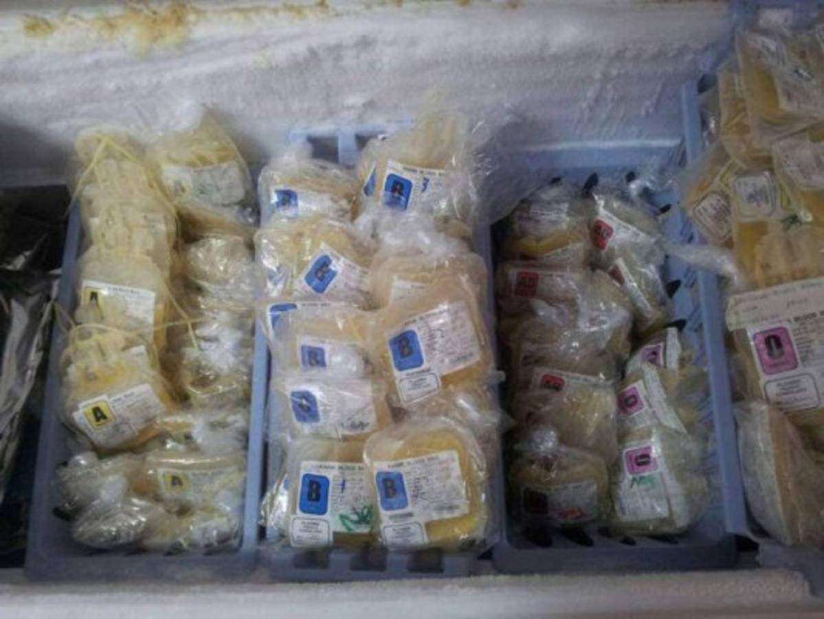 El HEU triplica capacidad de separación de componentes de la sangre  