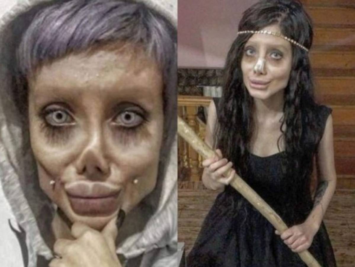 Revelan cómo era el rostro de 'Angelina Jolie zombie' antes de someterse a varias cirugías