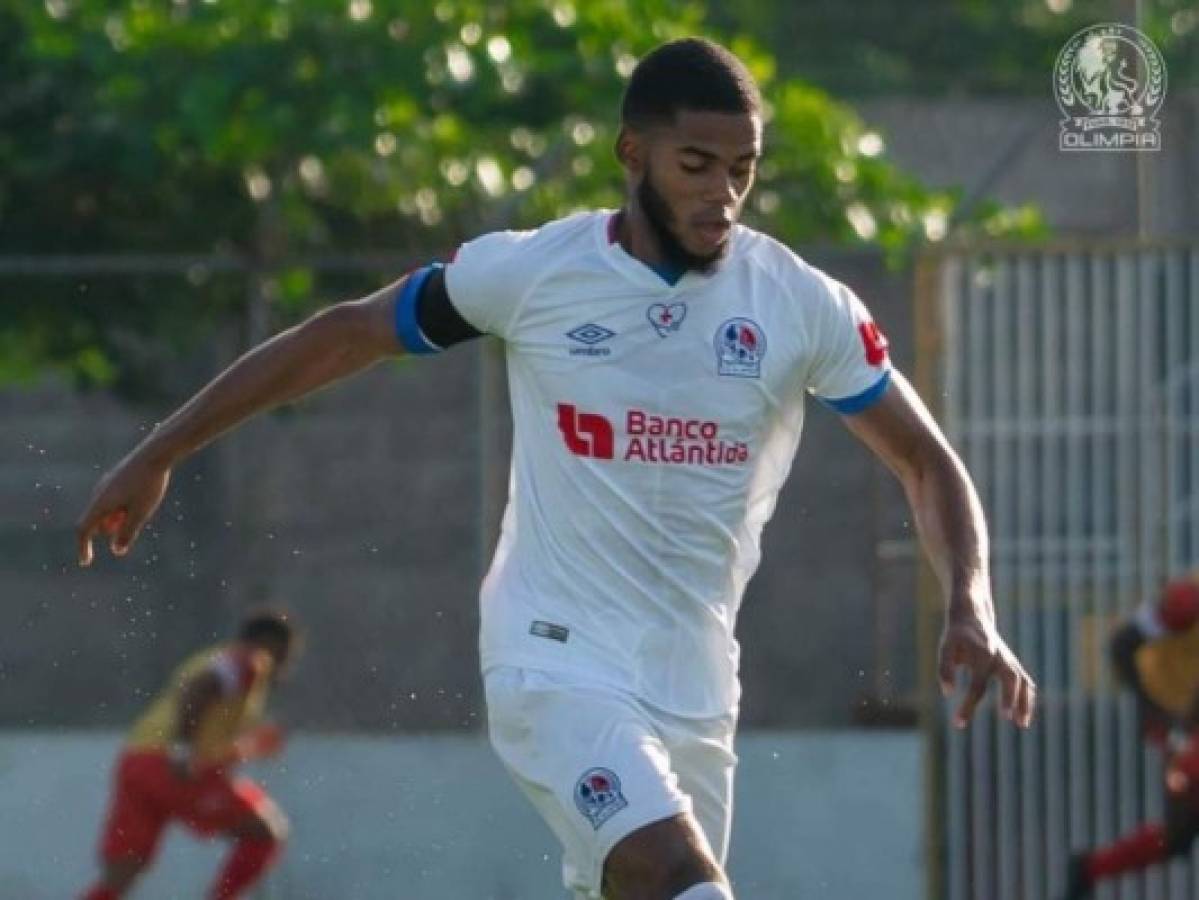 Elvin Casildo sufre grave lesión y se pierde el resto del Torneo Apertura 2021 con Olimpia